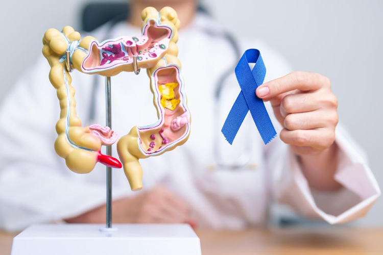 La Comunidad de Madrid logra el récord de participación en PREVECOLON con 357.000 pruebas, un 21% más